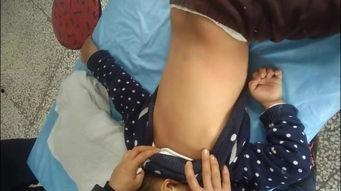 中医揪痧视频在线观看,在线视频教学，轻松掌握养生秘诀